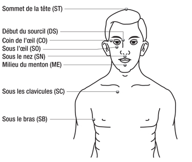 EFT : Technique de Libération Émotionnelle